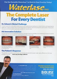 laser dentist san diego cosmetic dentist best porcelain dental veneers before after