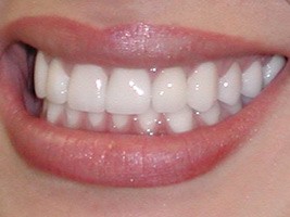 extra-oral-4