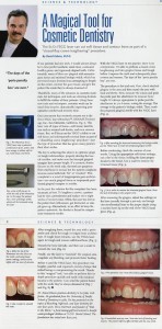 article san diego cosmetic dentist best porcelain dental veneers before after