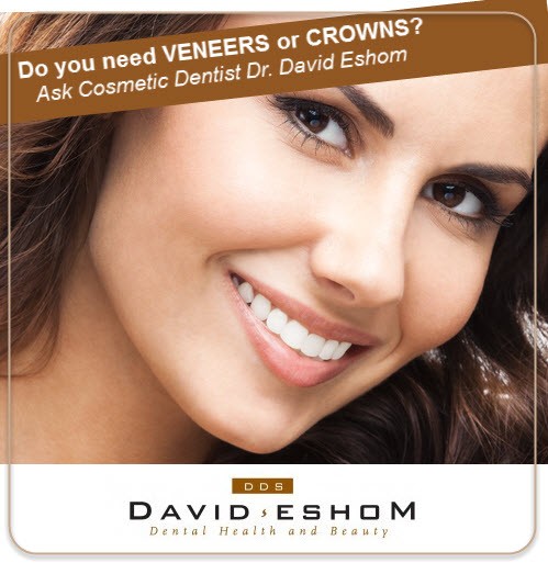 crowns or veneers cta