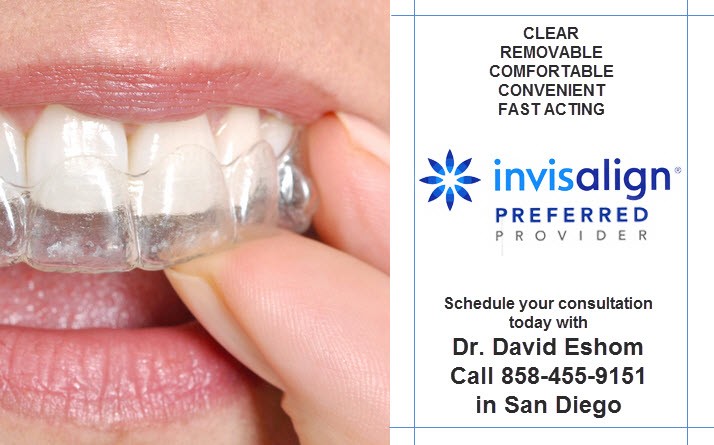 invisalign clear braces being installed