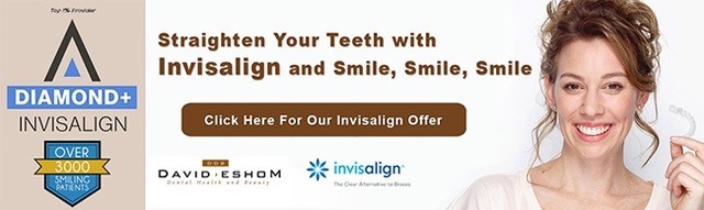 San Diego Invisalign