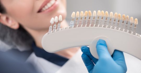 Porcelain Veneers or Bioclear Dental Veneers? Which is Better?